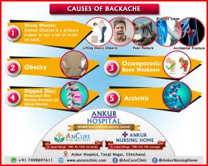 Backache Causes