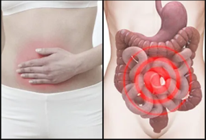 Treatment for lower abdominal pain
